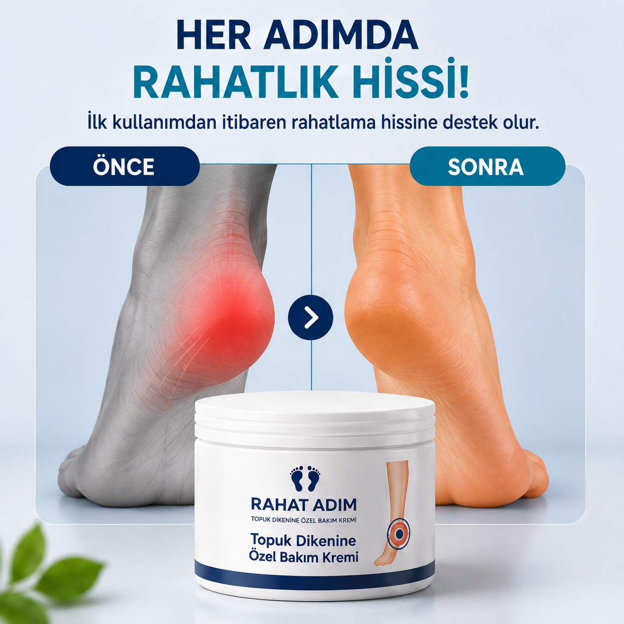 Rahat Adım Topuk Dikeni Kremi öncesi ve sonrası rahatlık hissi anlatımı